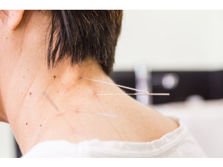 Pain Management Acupuncture in NYC | Back, Neck & Sciatica Relief