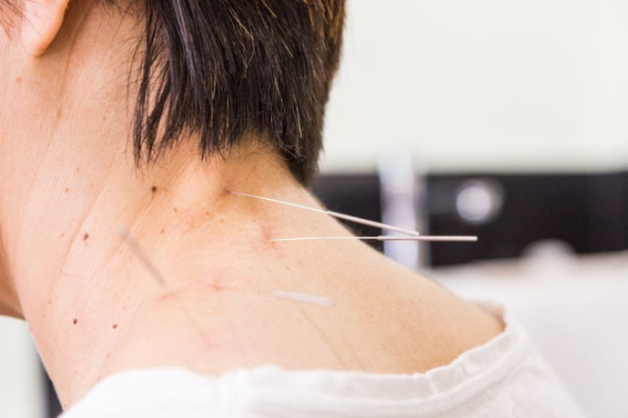 pain-management-acupuncture-in-nyc-back-neck-sciatica-relief-big-0