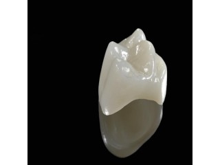 Convenient Same Day Crowns Available Near You