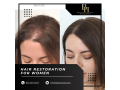 how-to-choose-the-right-treatment-of-hair-restoration-for-women-small-1