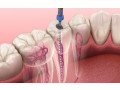 exceptional-dental-services-in-hudson-fl-small-0