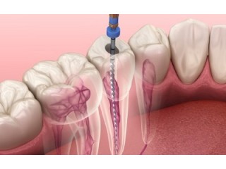 Exceptional Dental Services in Hudson, FL