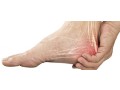 plantar-fasciitis-specialist-small-0