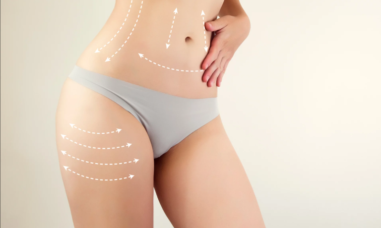 best-liposuction-clinic-in-dubai-big-1