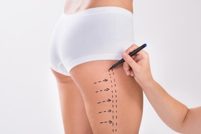 best-liposuction-clinic-in-dubai-big-4