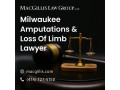 lost-a-limb-in-an-accident-milwaukee-lawyer-here-for-you-small-0