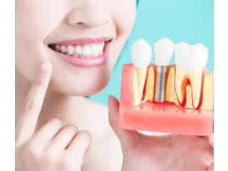 Fast Solutions for Missing Teeth