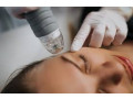 london-aesthetics-rejuvenation-centre-small-1