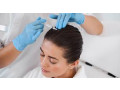 london-aesthetics-rejuvenation-centre-small-2