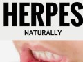 how-to-cure-herpes-12-naturally-small-1