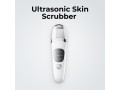 ultrasonic-skin-scrubber-small-0